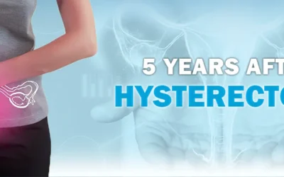 5 Years After Hysterectomy
