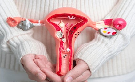 vaginal-hysterectomy