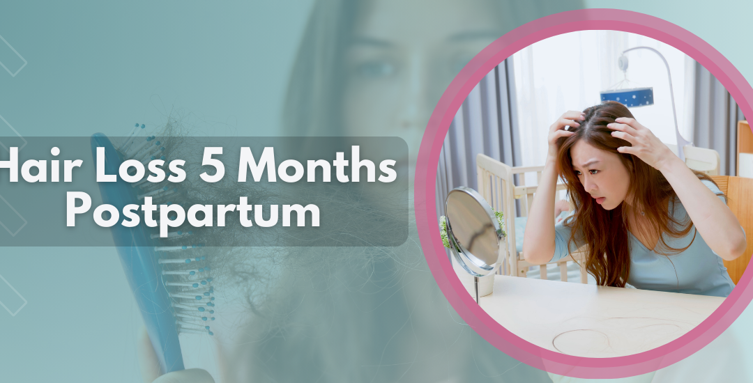 Hair_Loss_5_Months_Postpartum