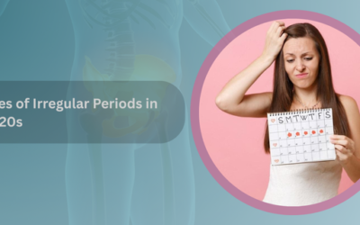 Causes of Irregular Periods in Your 20s