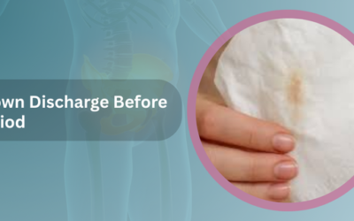 Brown Discharge Before Period