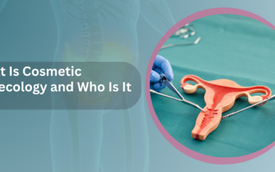 What Is Cosmetic Gynecology and Who Is It For?